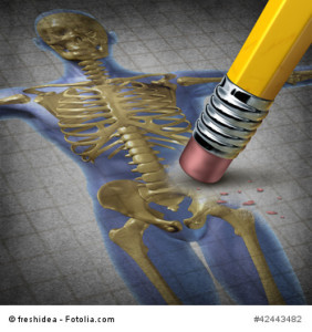 Human Osteoporosis