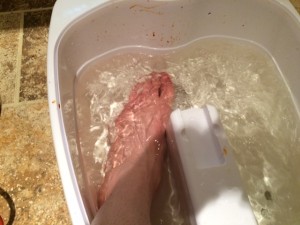 Betadine foot bath